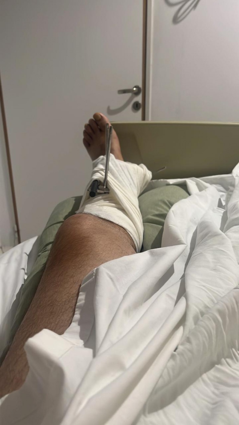 Javier Fras ser operado tras haber sido baleado en un asalto